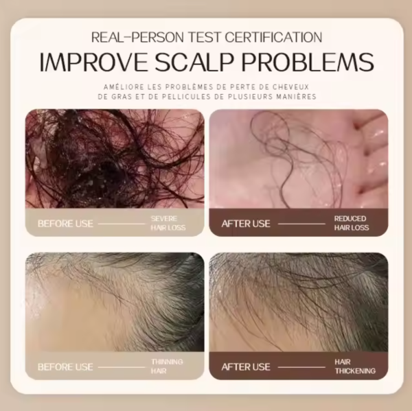 Hair Growth Shampoo - 300g - Image 3