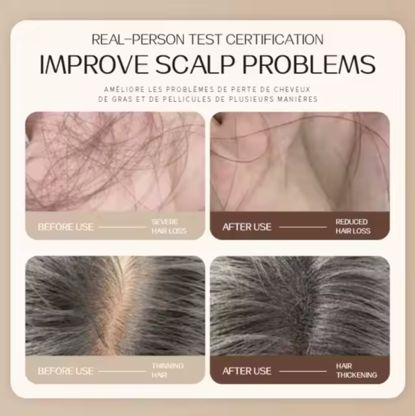 Hair Growth Shampoo - 300g - Image 5