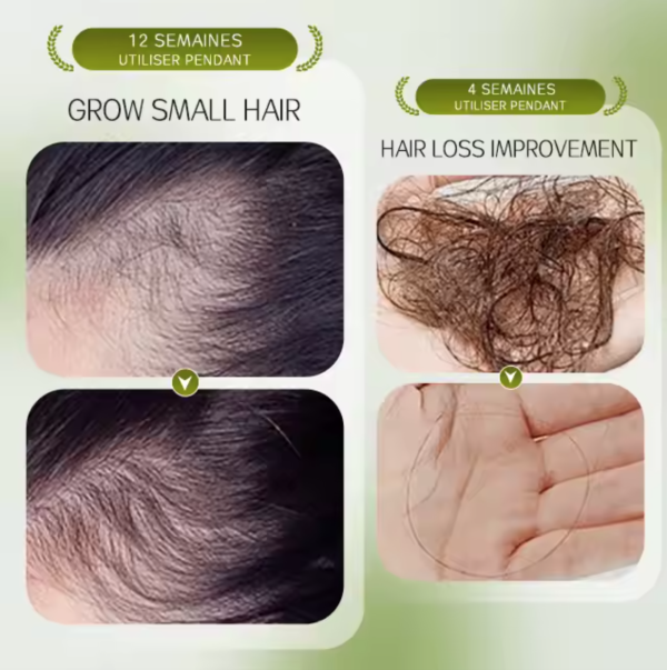 Hair Growth Serum - Image 4